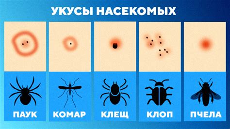 Почему укус осы так больно?