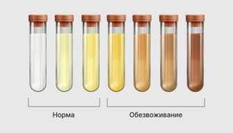 Почему у женщин может быть плохая моча?