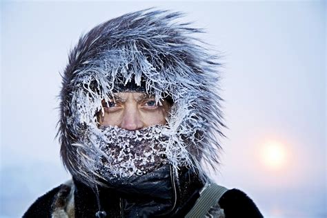 Почему человек чувствует холод в голове на солнце?