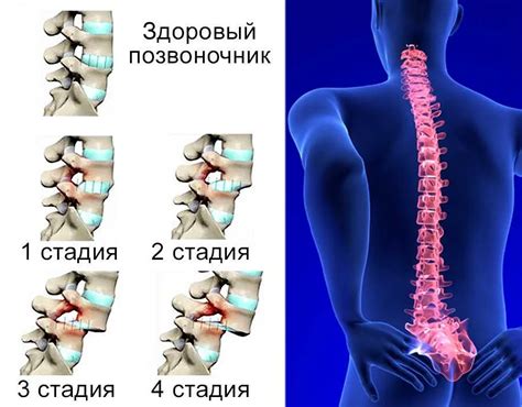 Почему шутки и подтягивания позвонков могут быть опасными?