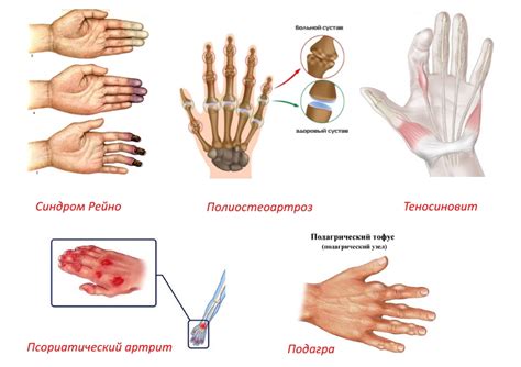 Появление и причины трясучки рук