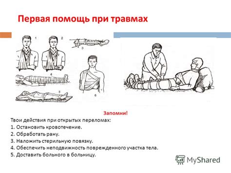 Правила оказания первой помощи при бытовых травмах