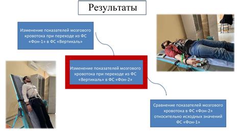 Правила подготовки к ортостатической пробе