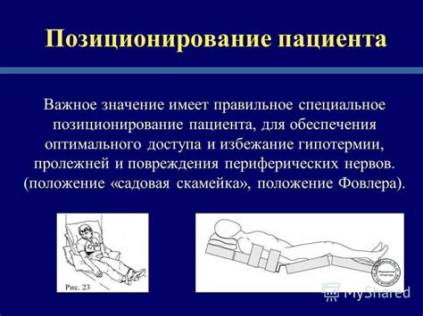 Правильное позиционирование овалов для оптимального эффекта