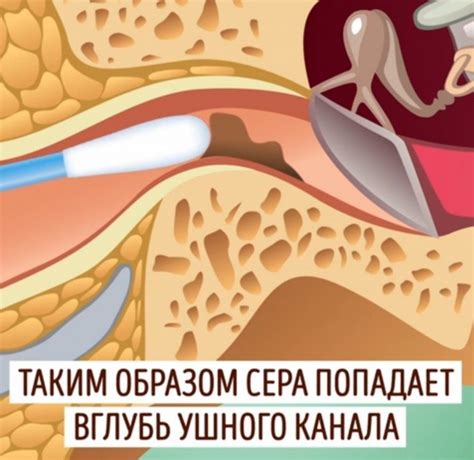 Предотвращение образования серной пробки