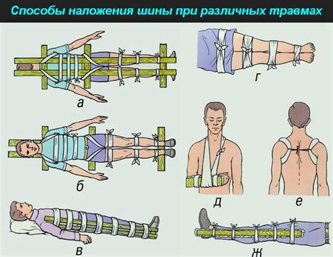 Предотвращение повреждения кожуры