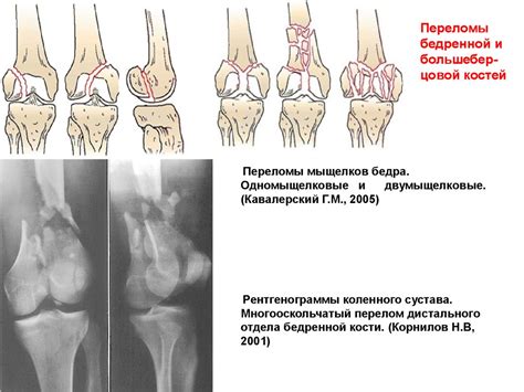 Предотвращение травматических повреждений