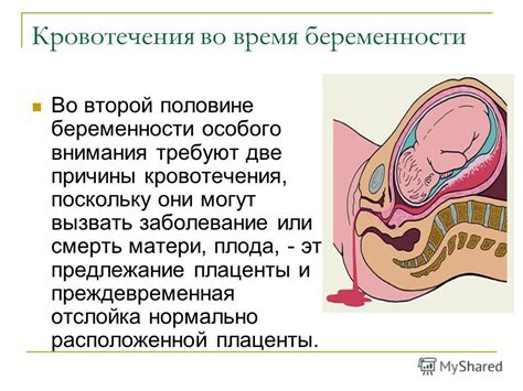 Преждевременная отделка от матери