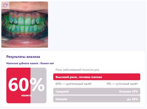 Преимущества йода в обработке полости рта: потенциальные результаты