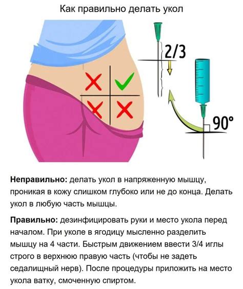 Преимущества прививок в ягодицу