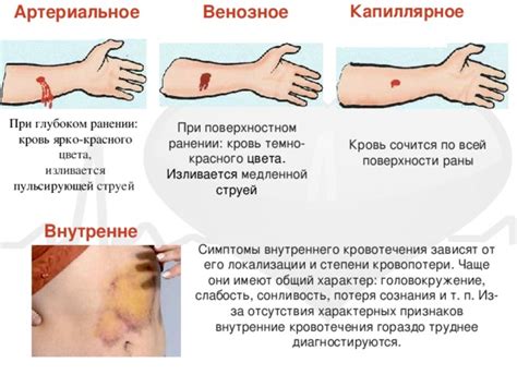 Придание эффекта кровь и раны