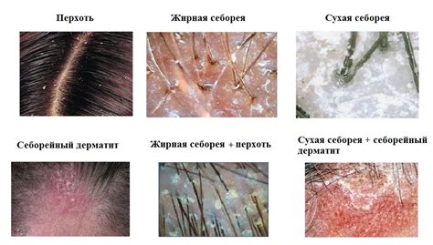 Признаки воспаления и раздражения кожи головы: что делать?