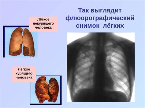 Признаки здоровых легких и патологий