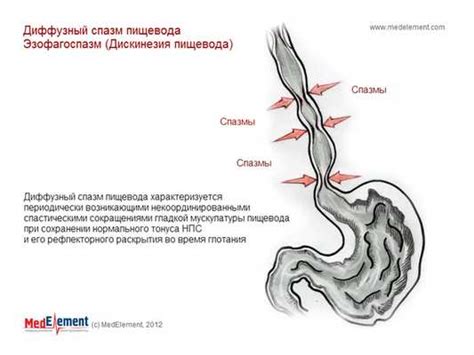 Признаки нарушения пищевода