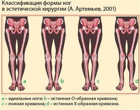 Признаки неравных ног