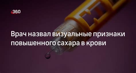 Признаки повышенного уровня жира в организме