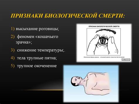 Признаки смерти: основные показатели и симптомы