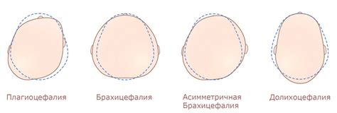 Примерные формы тела и головы