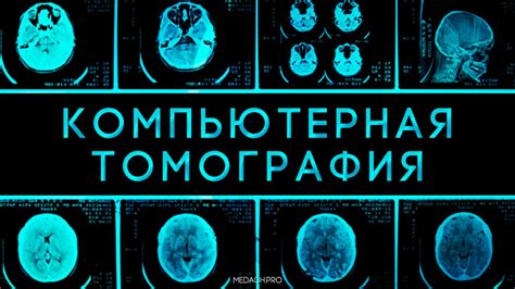 Принципы работы томографии мозга