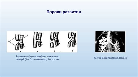 Принципы эхоэндоскопии органов