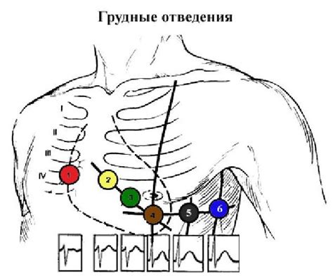 Принцип работы электрокардиограммы