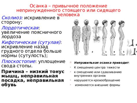 Причина №2: Неправильная посадка стопы