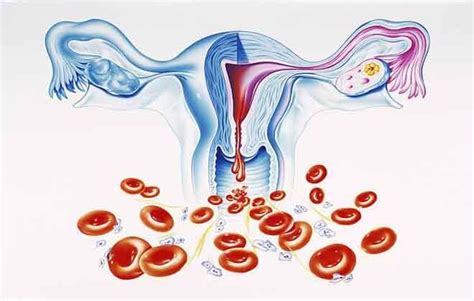 Причины возникновения кровотечения маточного и отношение к кофеину