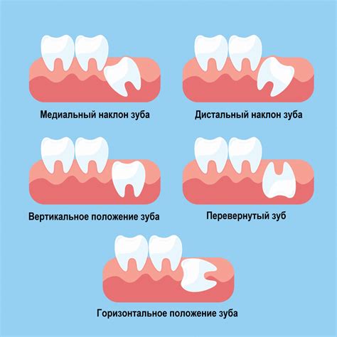 Причины возникновения лунки без сгустка