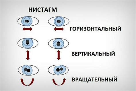 Причины возникновения проблемы глазных движений