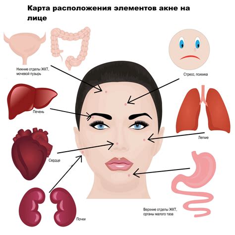 Причины возникновения прыщей на лице