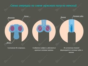 Причины желания смены пола