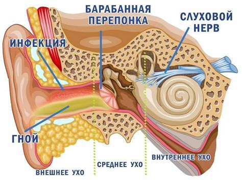 Причины заболевания червями в ушах