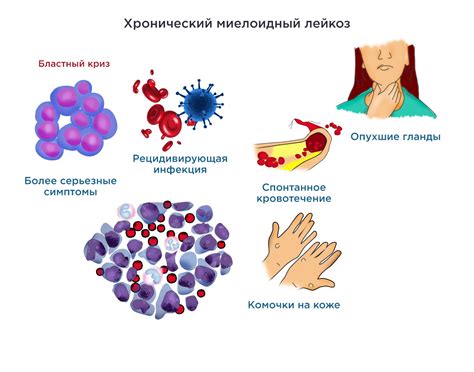 Причины застревания аллергенов и токсинов в крови