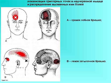 Причины звона в левой стороне головы