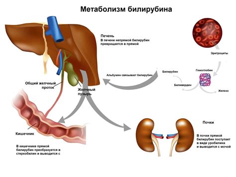 Причины и последствия повышения билирубина при синдроме Жильбера