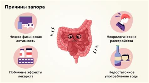 Причины и симптомы запора