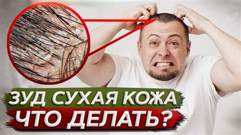 Причины и способы избавиться от сухости и зуда кожи на теле