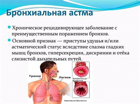 Причины коробочного звука при бронхиальной астме