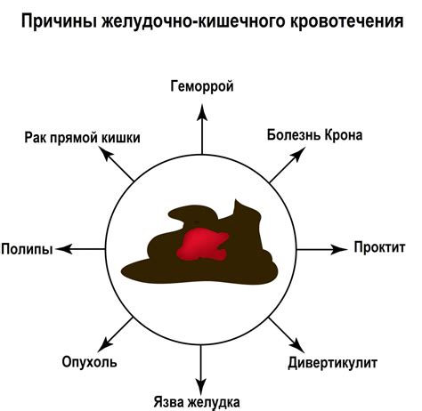 Причины кровотечения из пупка