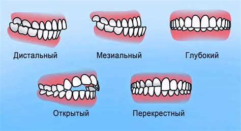 Причины неправильного дефекации у ребенка в год