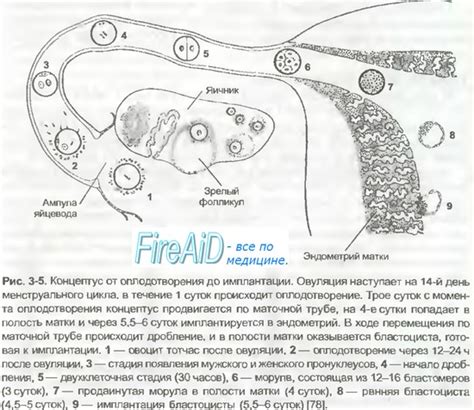 Причины неудачного прикрепления оплодотворенной яйцеклетки