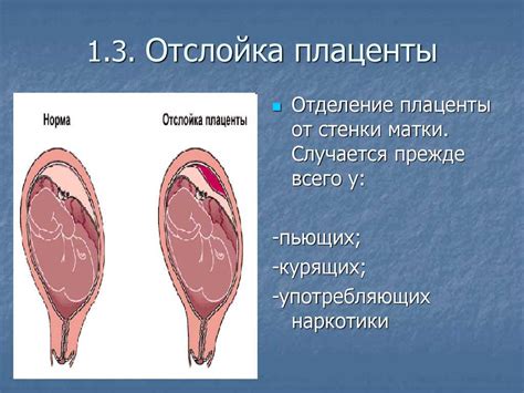 Причины отслойки плаценты на ранних сроках