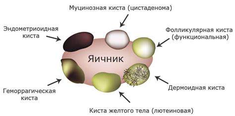 Причины отсутствия левого яичника