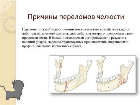 Причины переломов