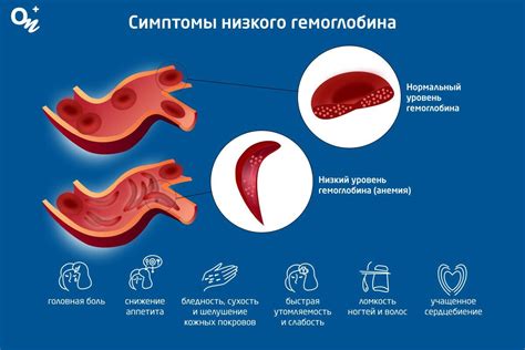 Причины повышения гемоглобина у женщин до 150