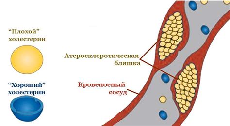 Причины повышенного роэ