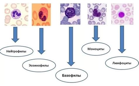 Причины повышенного уровня эозинофилов