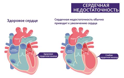 Причины пониженного давления при сердечной недостаточности