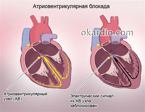 Причины продолжительности блокады