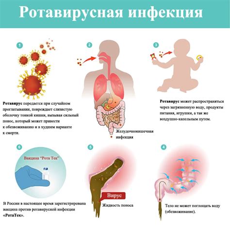 Причины развития инфекции хилактобактериями и основные симптомы